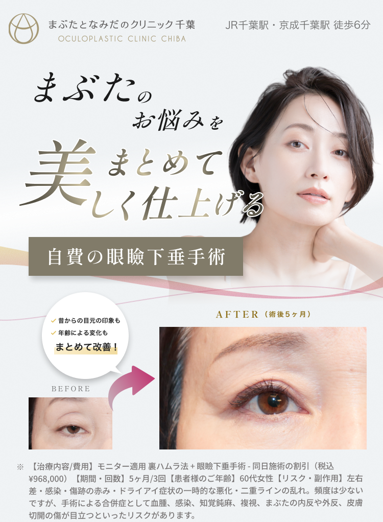 眼瞼下垂手術 まぶたとなみだのクリニック千葉