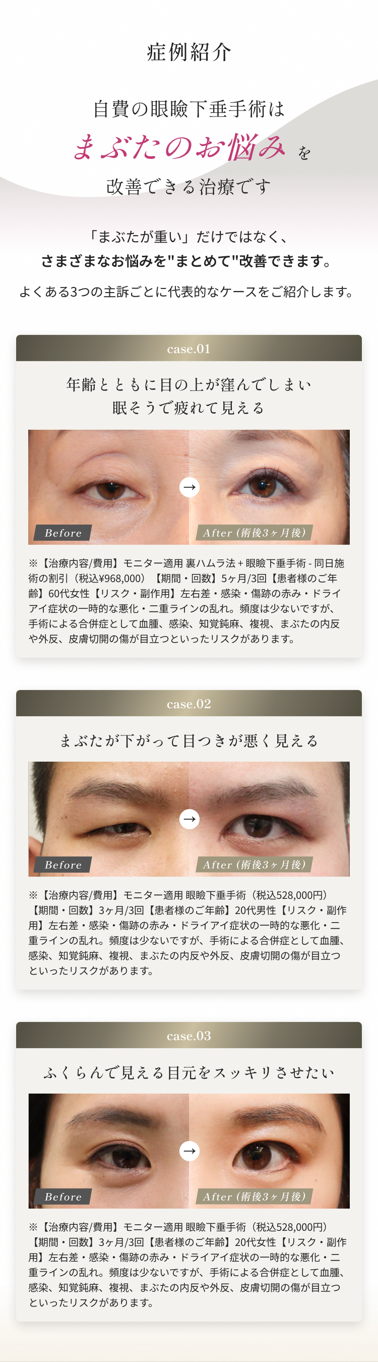 眼瞼下垂手術の症例