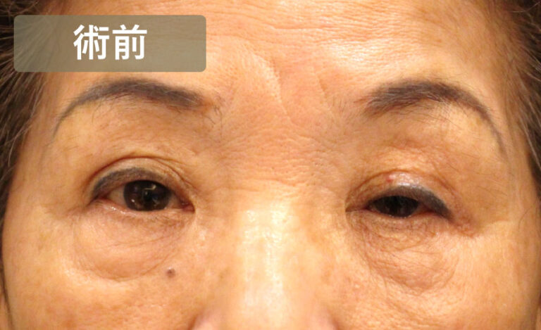 Before