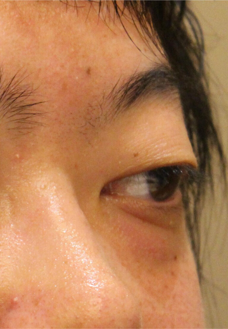 Before