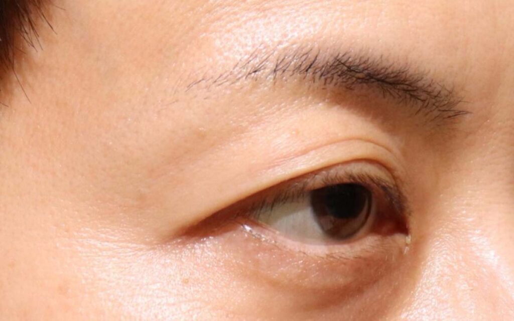 Before