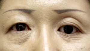 Before