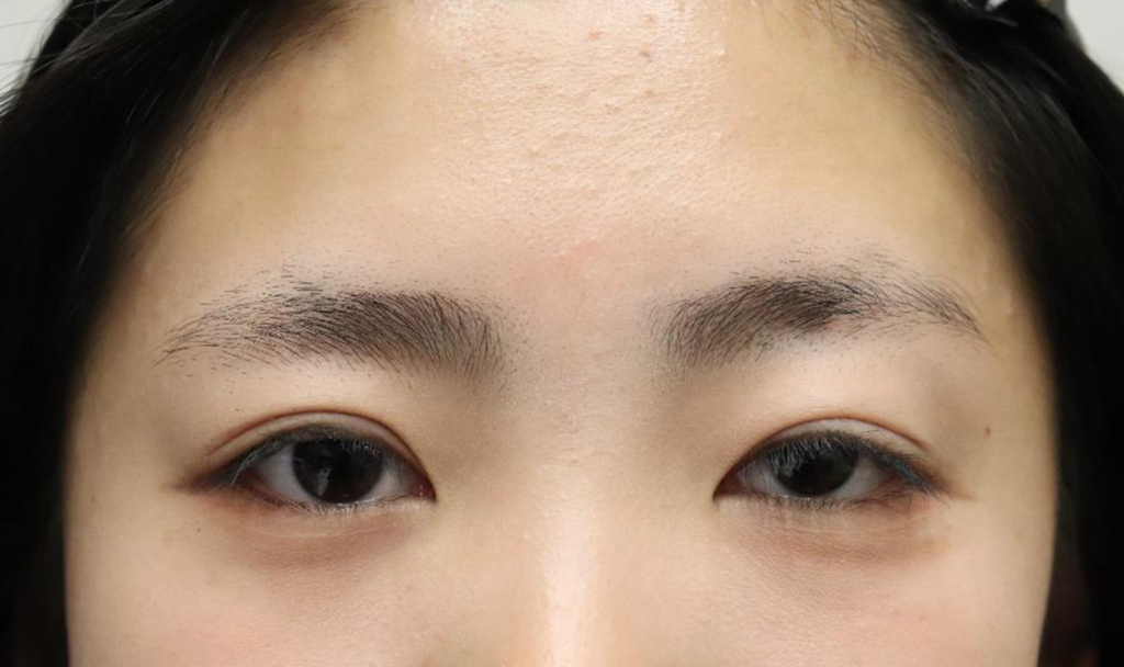 After
