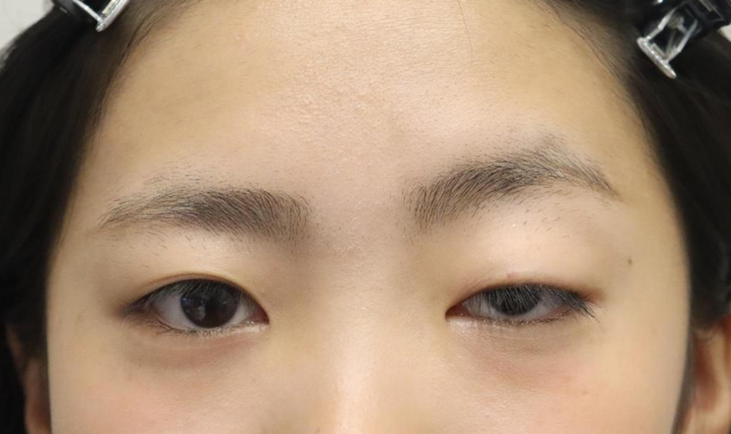 Before