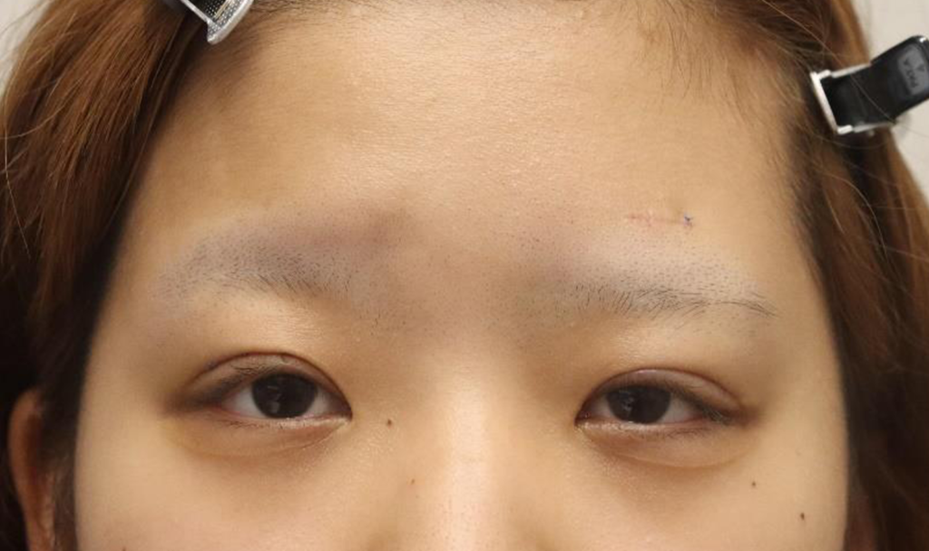 After