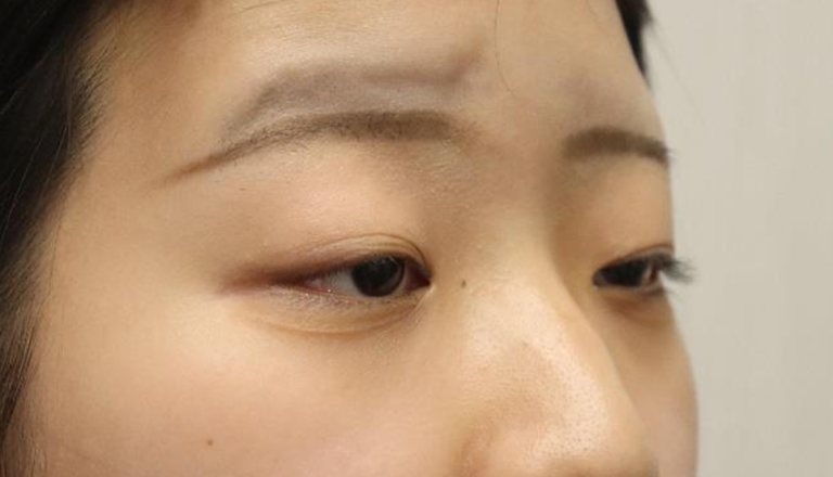 Before 2