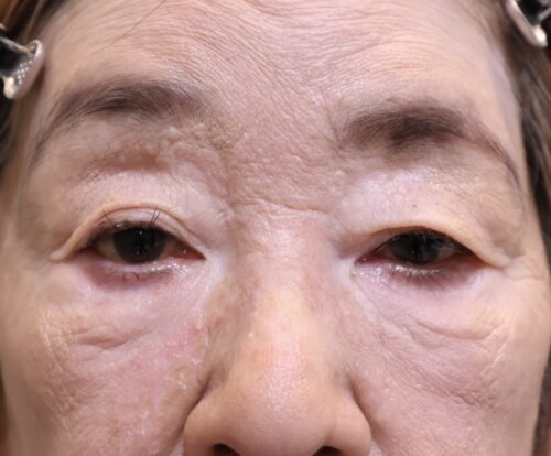 Before