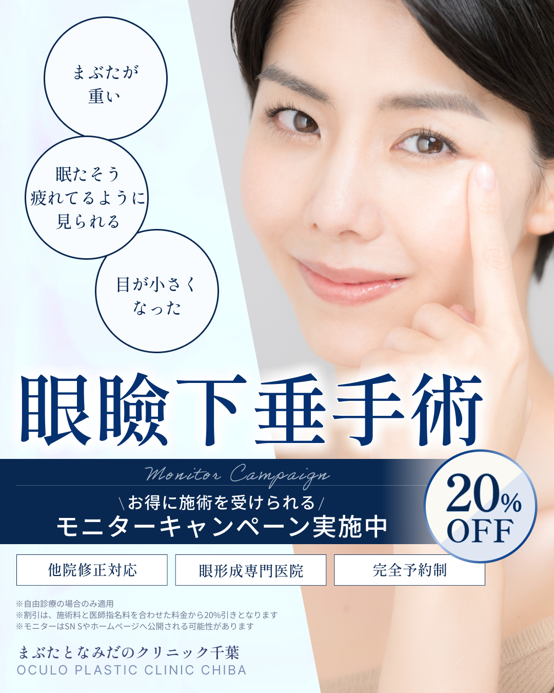 眼瞼下垂手術モニターキャンペーン20%OFF