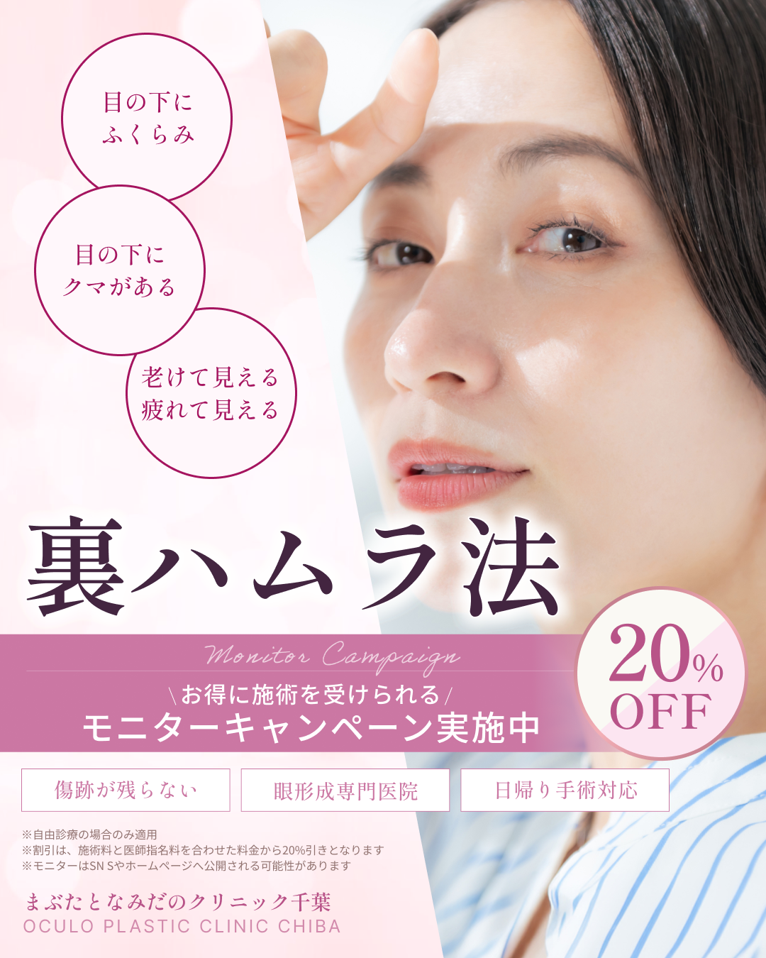 裏ハムラ法モニターキャンペーン20%OFF